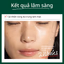 Kem dưỡng ốc sên đen Dr.G Black Snail Cream 50ml — 3