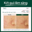 Mặt nạ làm dịu và cấp ẩm Dr.G R.E.D Blemish Hyal Cica Cooling Gel Mask — 3