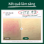 Sữa rửa mặt dịu nhẹ Dr.G pH R.E.D Blemish Clear Soothing Foam 150ml — 5