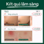 Kem CHỐNG NẮNG DỊU DA DR.G R.E.D BLEMISH SOOTHING UP SUN SPF 50+ PA++++ — 5