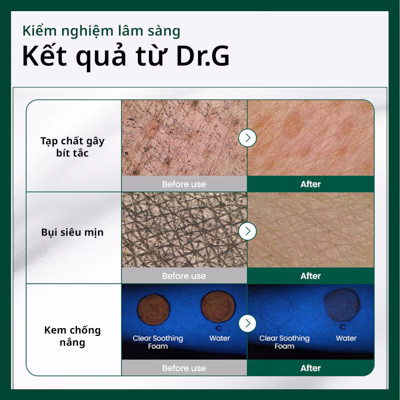 Nước cân bằng cấp ẩm và làm dịu Dr.G R.E.D Blemish Clear Soothing Toner 300ml