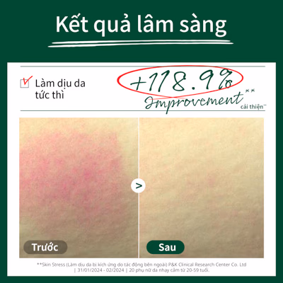 Sữa rửa mặt dịu nhẹ Dr.G pH R.E.D Blemish Clear Soothing Foam 150ml