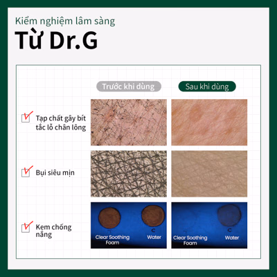 Sữa rửa mặt dịu nhẹ Dr.G pH R.E.D Blemish Clear Soothing Foam 150ml