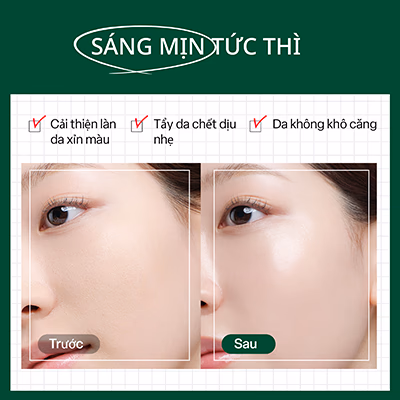 Gel tẩy tế bào chết dịu nhẹ Dr.G Brightening Peeling Gel 120ml