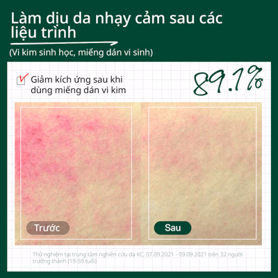 Kem dưỡng Dr.G R.E.D BLEMISH CLEAR SOOTHING CREAM 70ML
